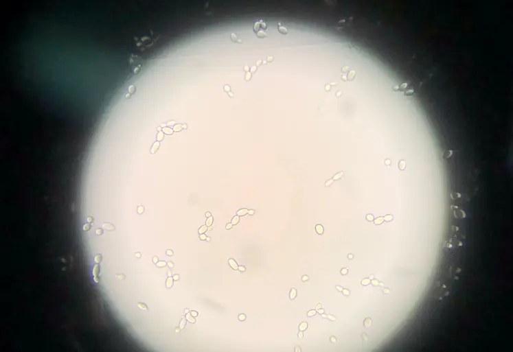 <em class="placeholder">Brettanomyces bruxellensis vue au microscope</em>