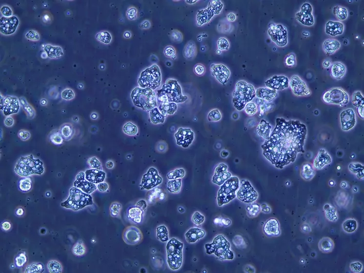 Les amibes sont des êtres unicellulaires eucaryotes, que l'on observe au microscope.