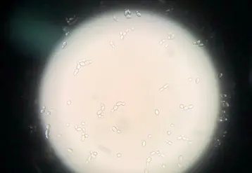 <em class="placeholder">Brettanomyces bruxellensis vue au microscope</em>
