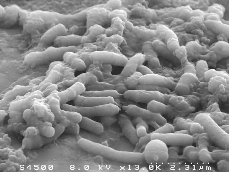 Flore du microbiote en microscopie électronique